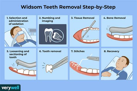 can i shower after wisdom teeth removal|Can You Actually Shower After a Wisdom Teeth。